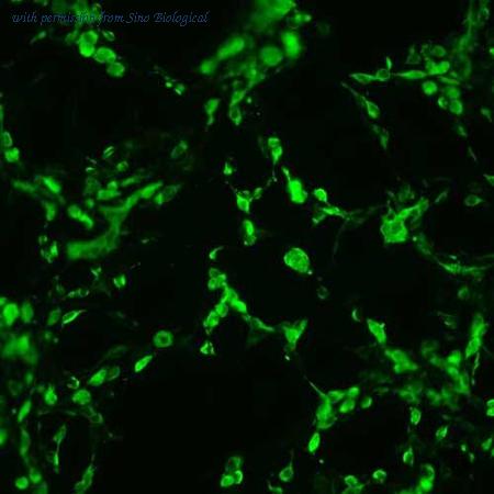 Sino Biological HG11428-CF image 1