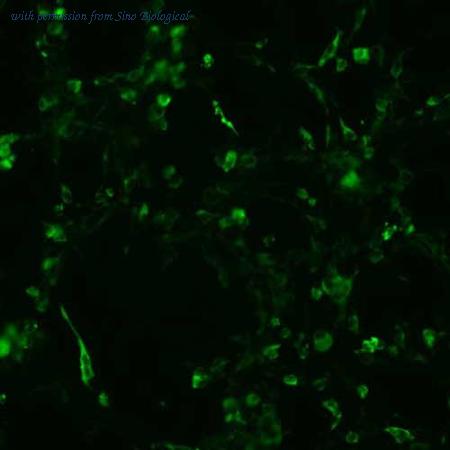 Sino Biological HG11152-CF image 1