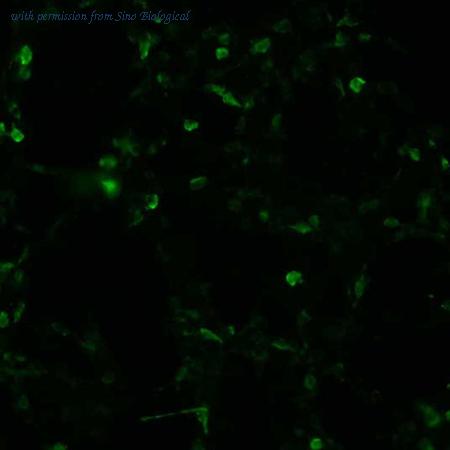 Sino Biological HG11138-CF image 1