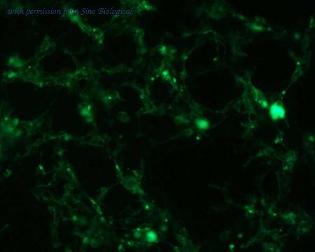 Sino Biological HG11102-ACG image 1