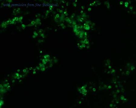 Sino Biological HG11091-ACG image 1