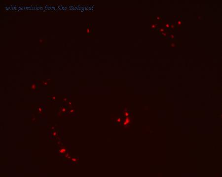 Sino Biological HG10947-ACR image 1