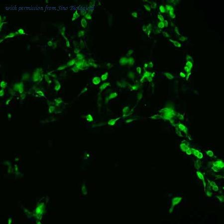 Sino Biological HG10925-CF image 1