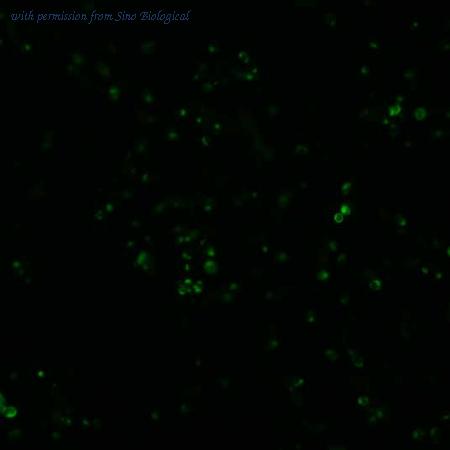 Sino Biological HG10896-ACG image 1