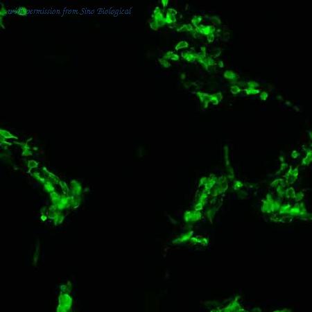 Sino Biological HG10657-CF image 1