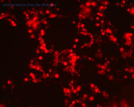 Sino Biological HG10398-ACR image 1