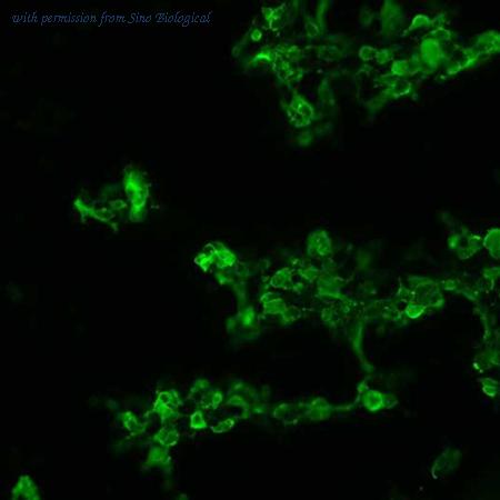 Sino Biological HG10374-CF image 1