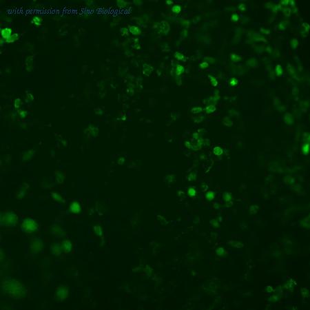 Sino Biological HG10196-CF image 1