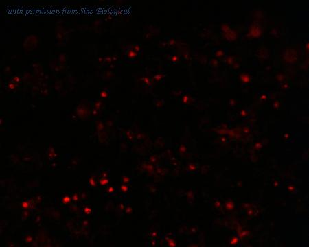Sino Biological HG10171-ACR image 1