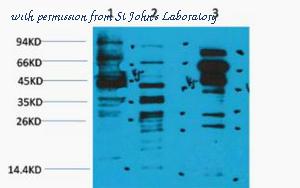 St John's Laboratory STJ97181 image 1