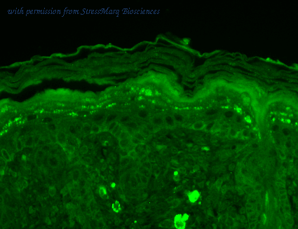 StressMarq Biosciences SMC-336 image 1