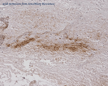 StressMarq Biosciences SMC-208 image 1