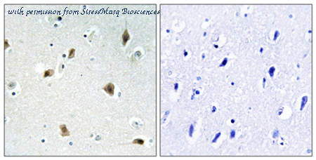 StressMarq Biosciences SPC-1282 ͼ 1