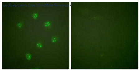 StressMarq Biosciences SPC-1327D ͼ 1