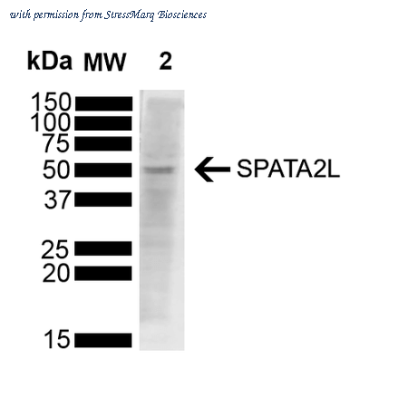 StressMarq Biosciences SMC-558D image 1