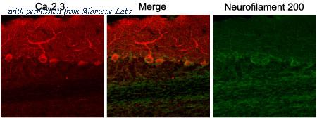 Alomone Labs ACC-006 image 2