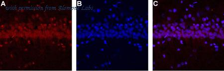 Alomone Labs ACC-101-AR image 1