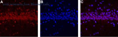 Alomone Labs ACC-101-AR image 2
