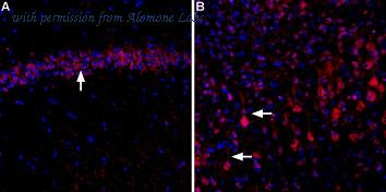 Alomone Labs ACC-103-AR image 1