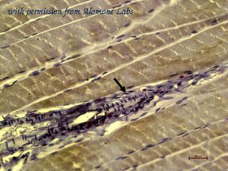 Alomone Labs ACC-314 image 2