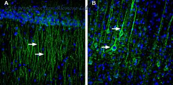 Alomone Labs ACL-004 image 2