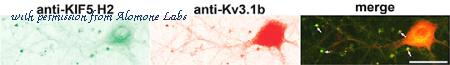 Alomone Labs APC-014 image 3
