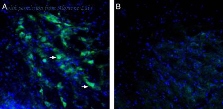 Alomone Labs APC-038 image 2