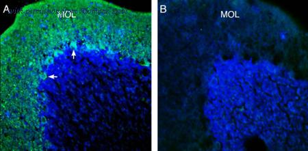Alomone Labs APC-124 image 2