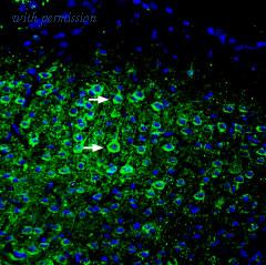 Alomone Labs ASC-032 image 2