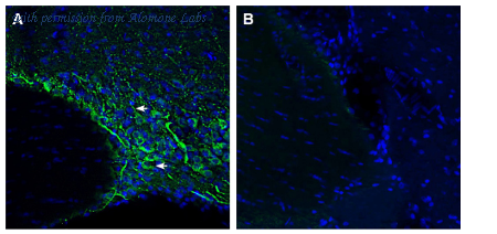 Alomone Labs AGT-036 image 2