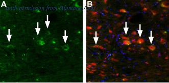 Alomone Labs BLP-CC083 image 1
