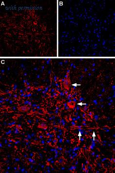 Alomone Labs BLP-CC116 image 1