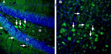 Alomone Labs BLP-GR053 image 1