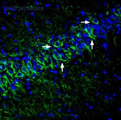 Alomone Labs BLP-PC169 image 1