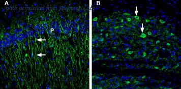 Alomone Labs BLP-SR022 image 1
