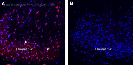 Alomone Labs ACC-037-GP image 3