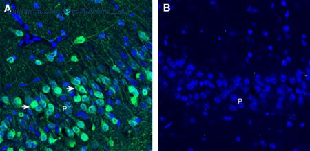 Alomone Labs AGR-093 image 3