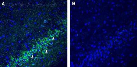 Alomone Labs ANT-122 image 3