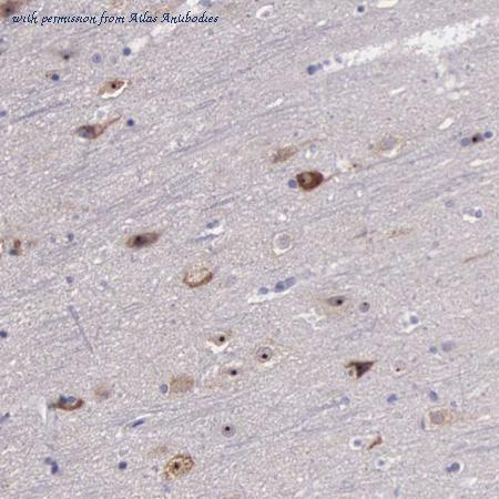 Atlas Antibodies AMAb90630 image 1