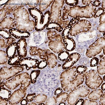 atlas antibodies hpa008773 图像 1