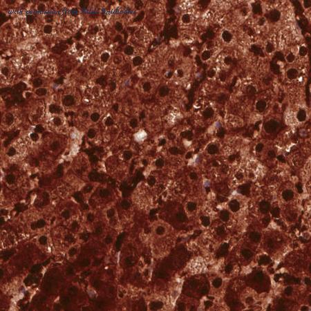 Atlas Antibodies AMAb90545 image 1