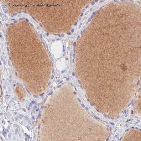 Atlas Antibodies AMAb90649 image 2