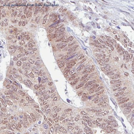 Atlas Antibodies AMAb90655 image 2