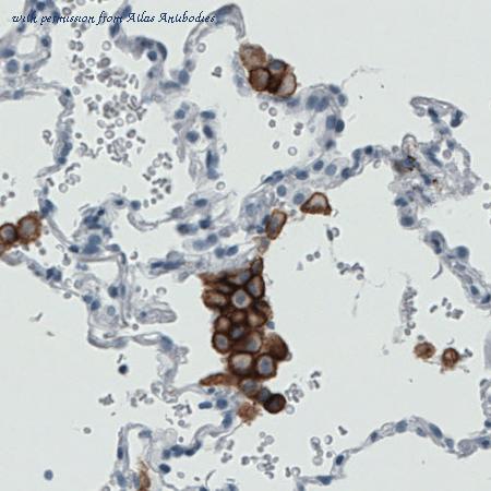 Atlas Antibodies AMAb90746 image 1