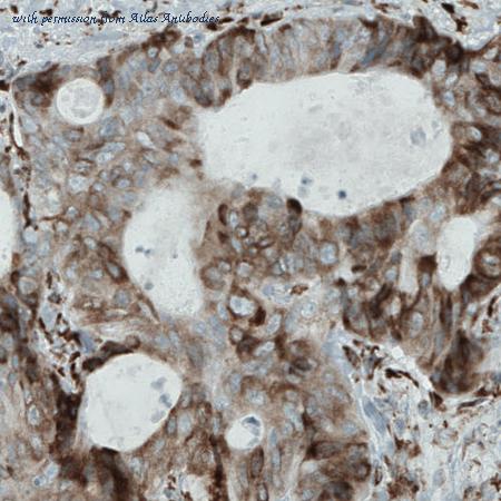 Atlas Antibodies AMAb90762 image 3