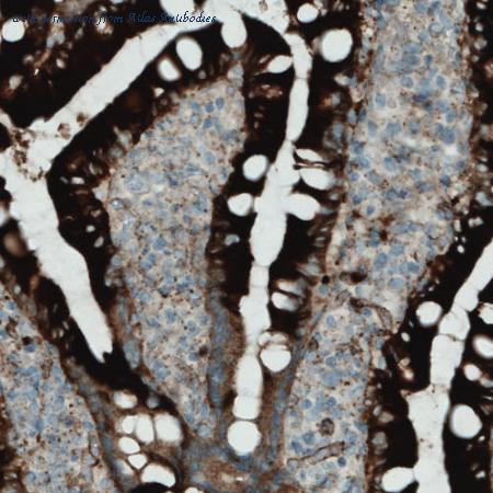 Atlas Antibodies AMAb90769 image 1