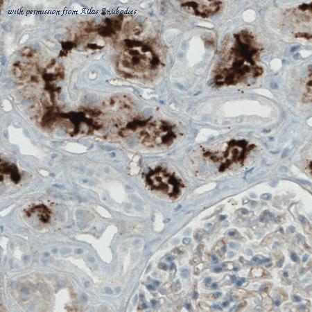Atlas Antibodies AMAb90769 image 2