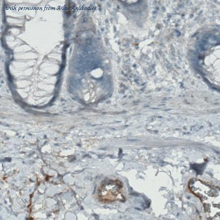 Atlas Antibodies AMAb90769 image 3