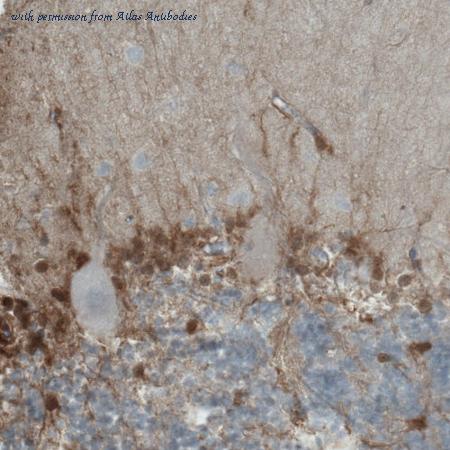Atlas Antibodies AMAb90786 image 2