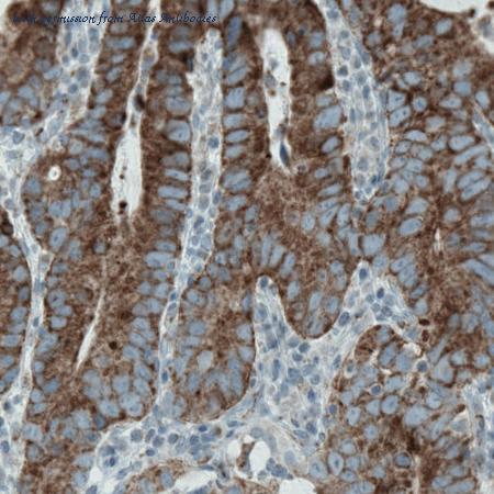 Atlas Antibodies AMAb90832 image 2